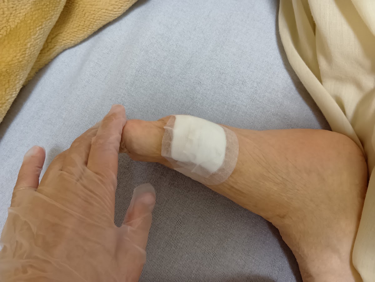 訪問先での処置・手元のケア